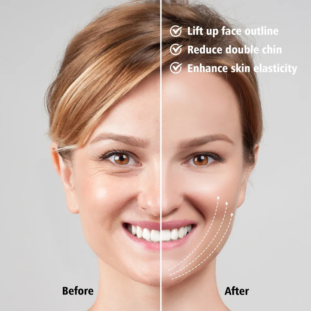 EMS V-Face Lift Device